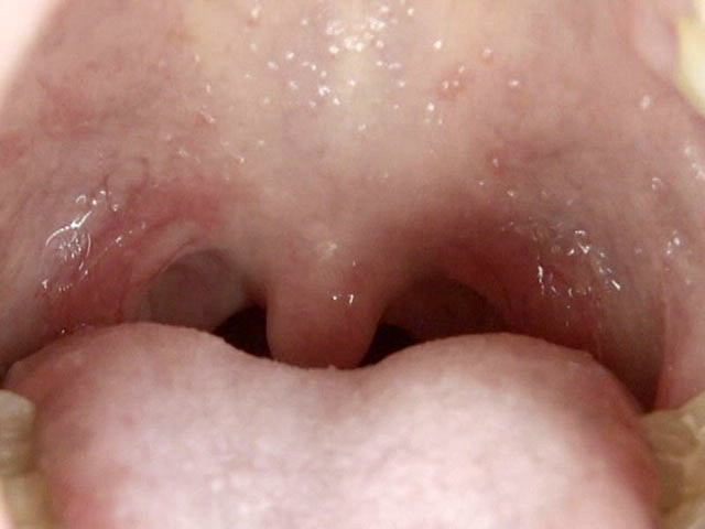 GA-246 第 10 部分 - 66 分钟