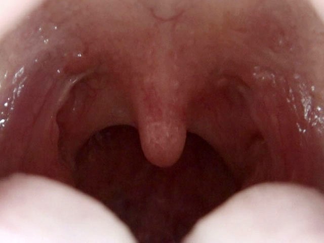 GA-246 第 13 部分 - 78 分钟