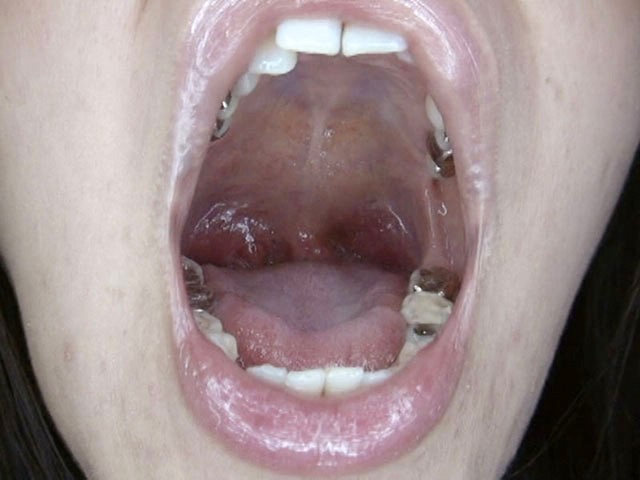 GA-246 第 14 部分 - 82 分钟