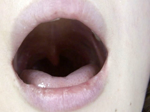 GA-246 第 15 部分 - 86 分钟