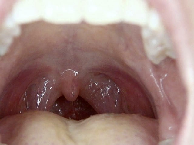 GA-246 第 19 部分 - 102 分钟