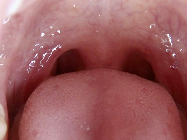 GA-246 第 2 部分 - 34 分钟