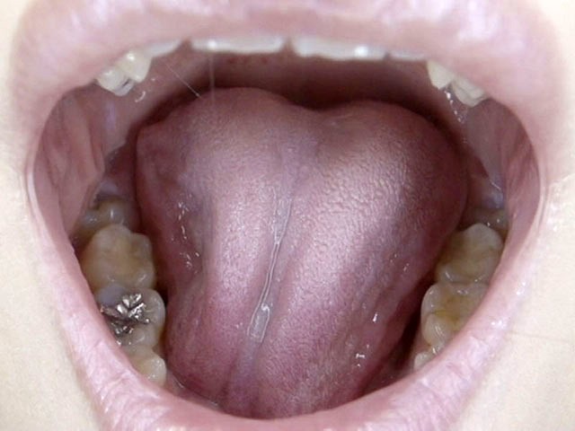 GA-246 第 20 部分 - 106 分钟