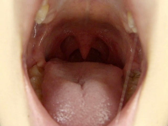 GA-246 第 3 部分 - 38 分钟