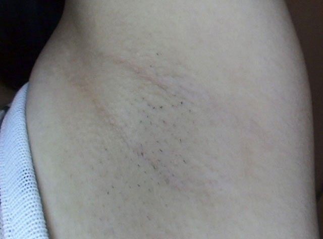 GA-261 第 1 部分 - 30 分钟