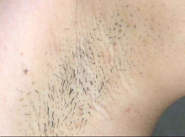 GA-261 第 10 部分 - 66 分钟