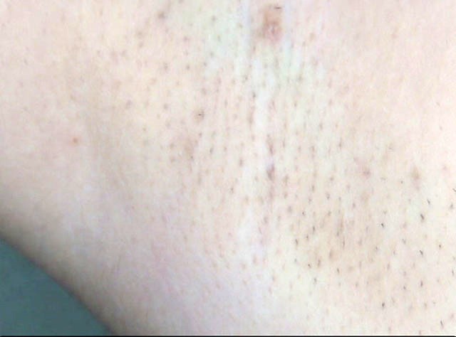 GA-261 第 11 部分 - 70 分钟