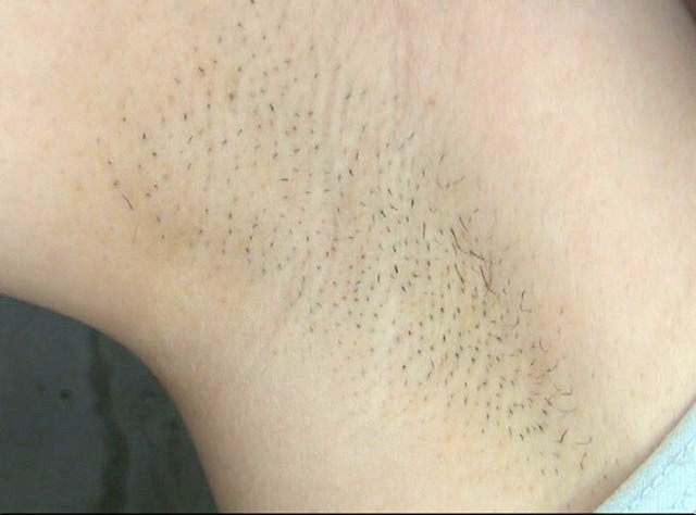 GA-261 第 13 部分 - 78 分钟