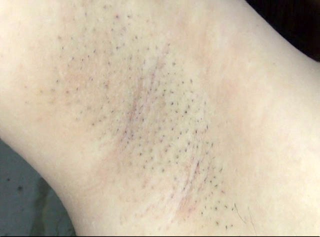 GA-261 第 20 部分 - 106 分钟