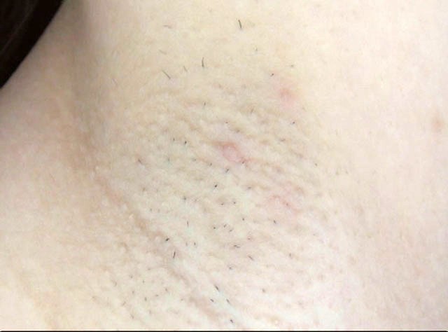 GA-261 第 3 部分 - 38 分钟