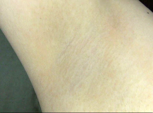 GA-261 第 5 部分 - 46 分钟