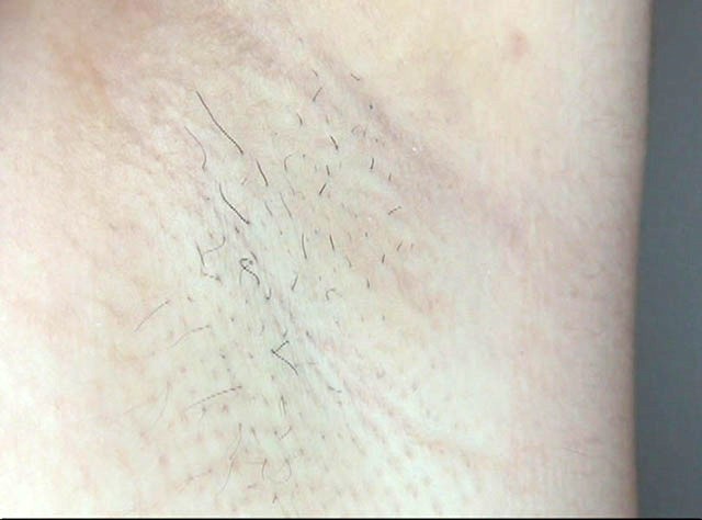 GA-261 第 6 部分 - 50 分钟