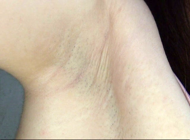 GA-261 第 7 部分 - 54 分钟