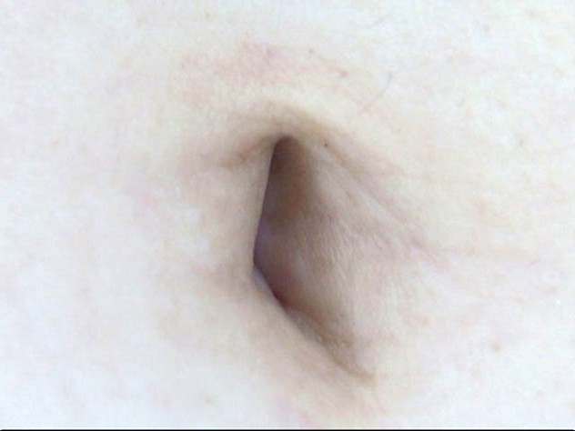 GA-264 第 1 部分 - 30 分钟