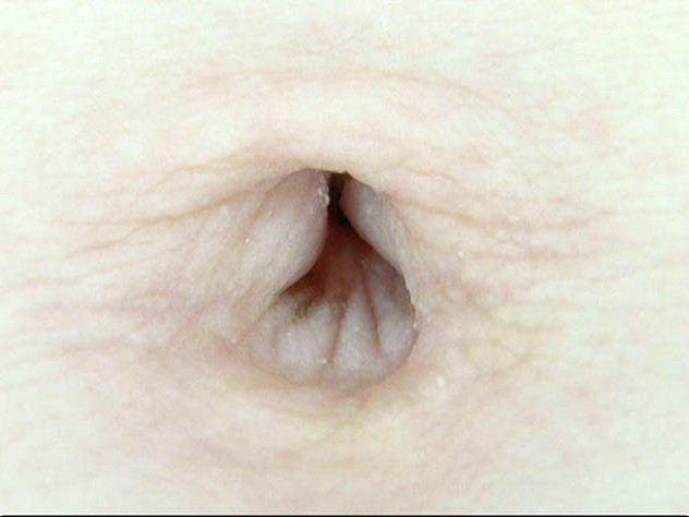 GA-264 第 10 部分 - 66 分钟