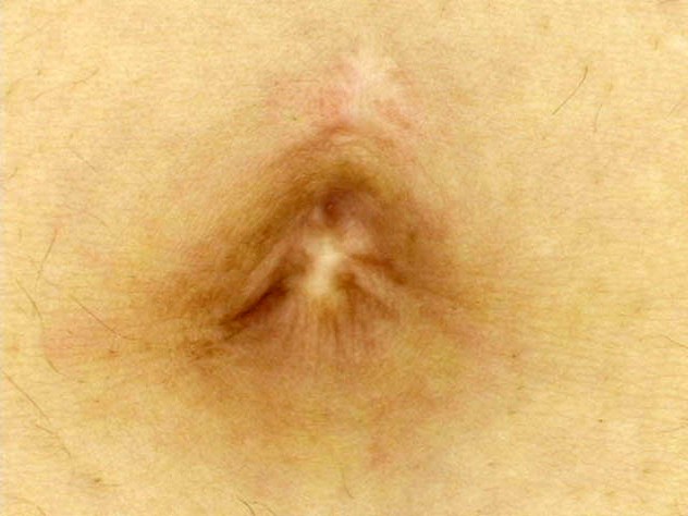 GA-264 第 11 部分 - 70 分钟