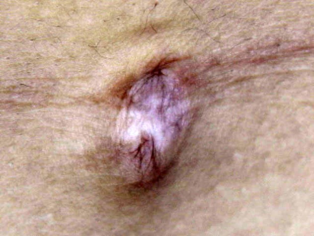 GA-264 第 13 部分 - 78 分钟