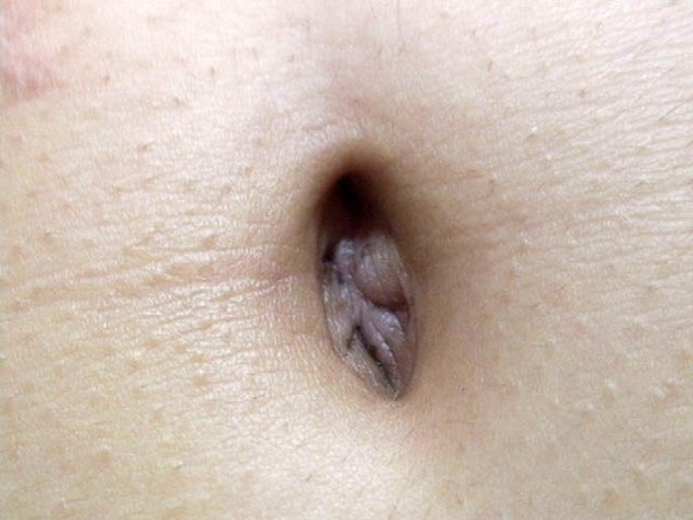 GA-264 第 14 部分 - 82 分钟