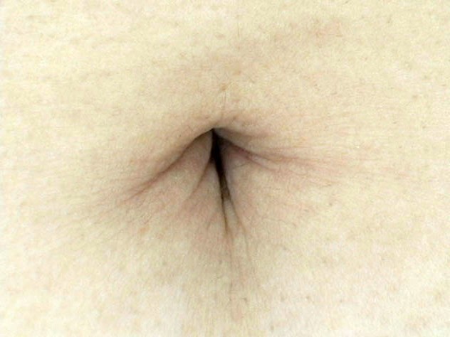 GA-264 第 17 部分 - 94 分钟