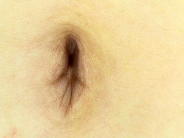 GA-264 第 3 部分 - 38 分钟