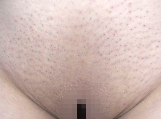 GA-267 第 15 部分 - 100 分钟