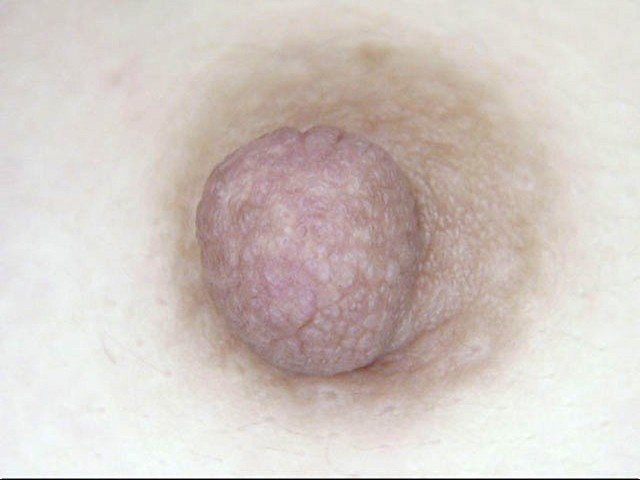 GA-43600273 Part 18 - 98 minutes