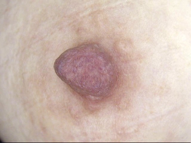 GA-43600273 Part 5 - 46 minutes