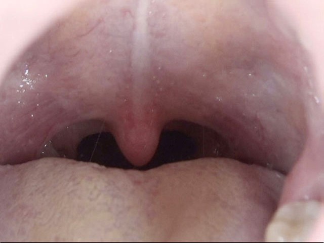 GA-275 第 12 部分 - 74 分钟