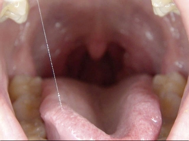 GA-275 第 13 部分 - 78 分钟