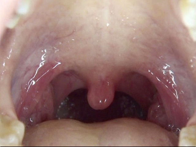 GA-275 第 14 部分 - 82 分钟