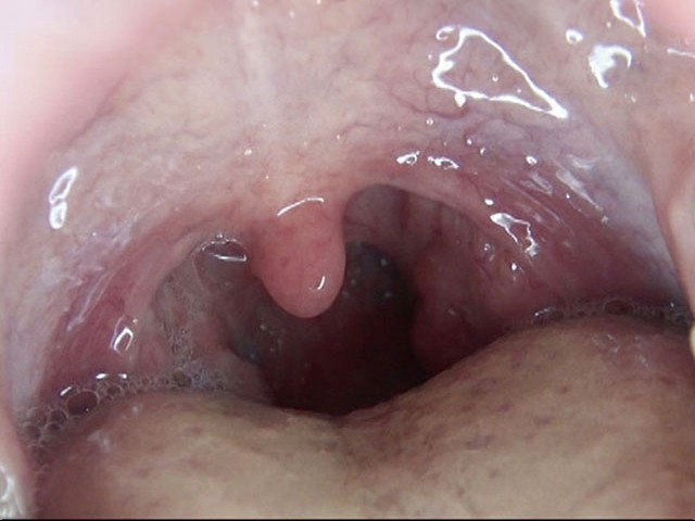 GA-275 第 17 部分 - 94 分钟