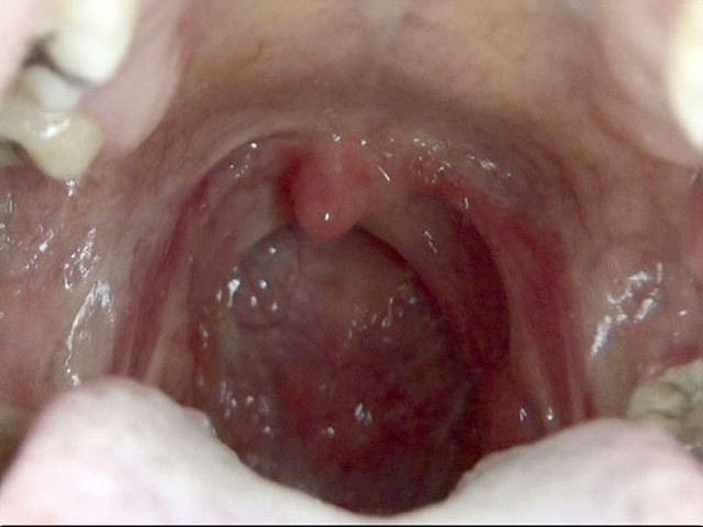 GA-275 第 19 部分 - 102 分钟