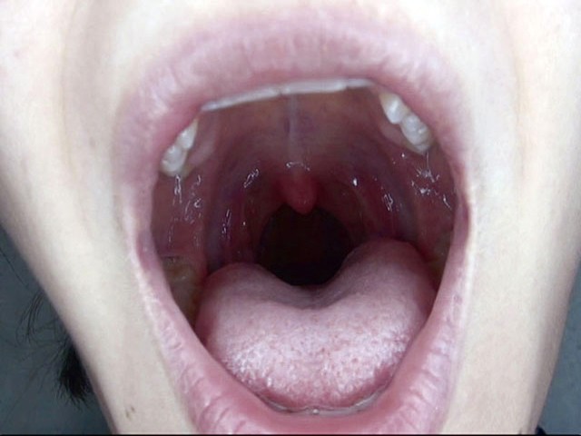 GA-275 第 20 部分 - 106 分钟