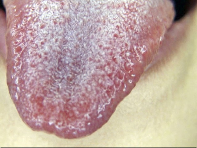 GA-275 第 3 部分 - 38 分钟