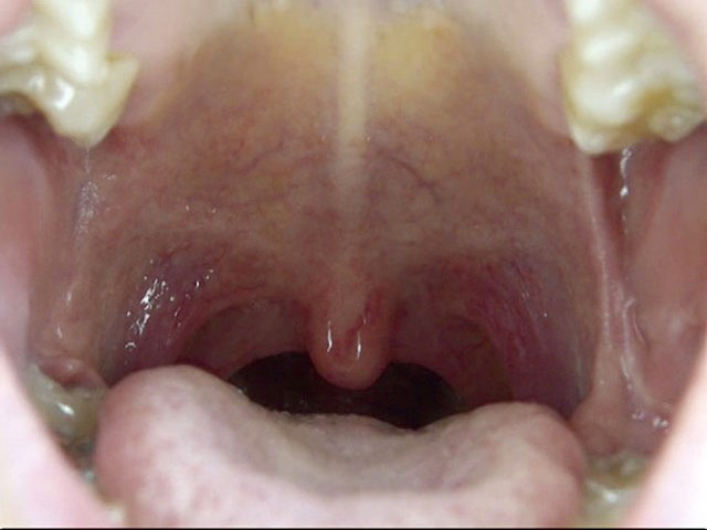 GA-275 第 8 部分 - 58 分钟