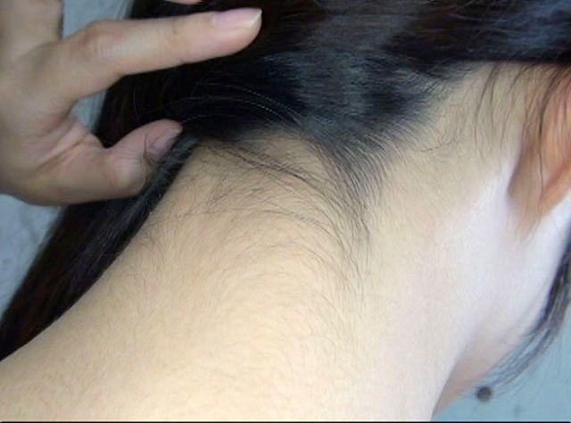 GA-278 第 10 部分 - 102 分钟