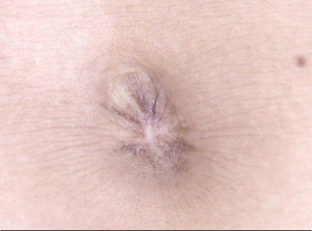 GA-279 Part 18 - 98 minutes