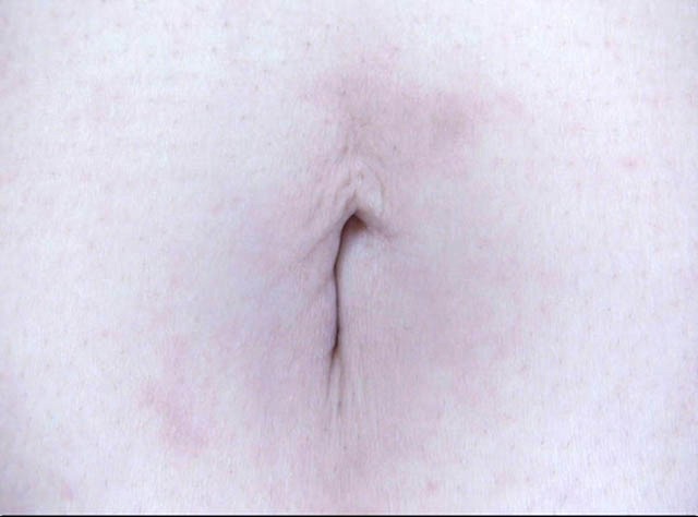 GA-279 Part 19 - 102 minutes