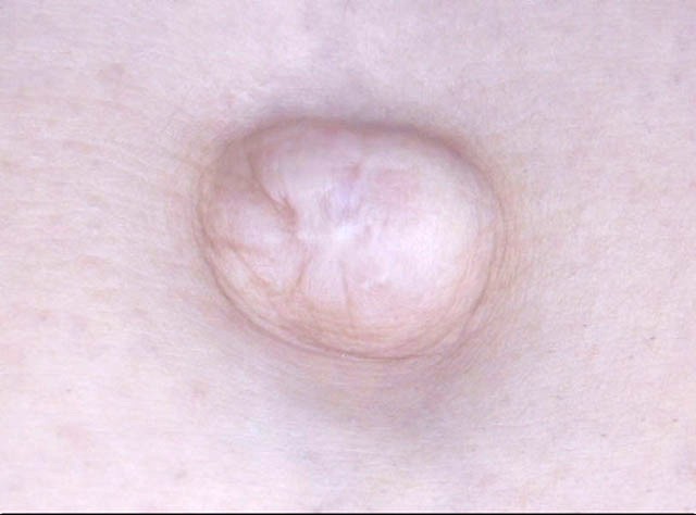 GA-279 Part 4 - 42 minutes