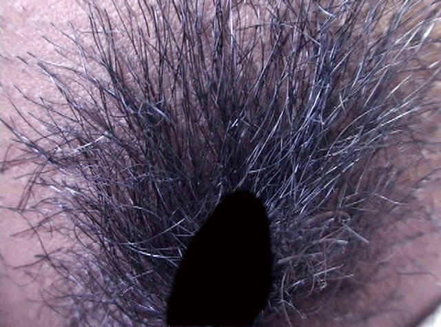 GA-281 Bagian 15 - 86 minit