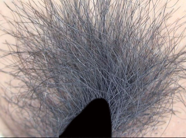 GA-281 Bagian 9 - 62 minit