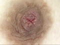 100人の乳首 第5集 - FANZA版サンプル画像