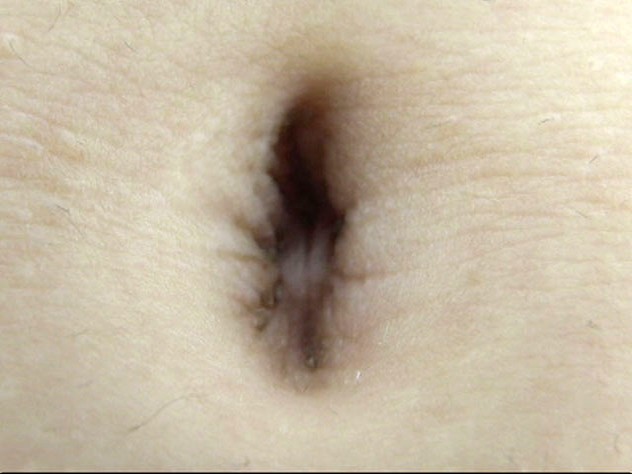 GA-291 Bagian 15 - 86 minit