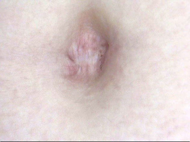 GA-291 Part 20 - 106 minutes