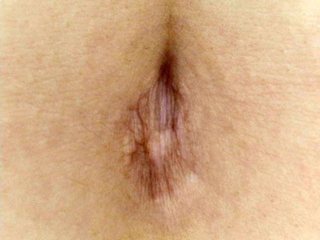 GA-291 Part 8 - 58 minutes