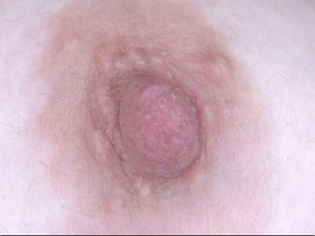 GA-294 第 10 部分 - 75 分钟