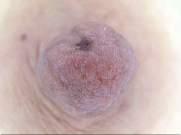 GA-294 第 11 部分 - 80 分钟