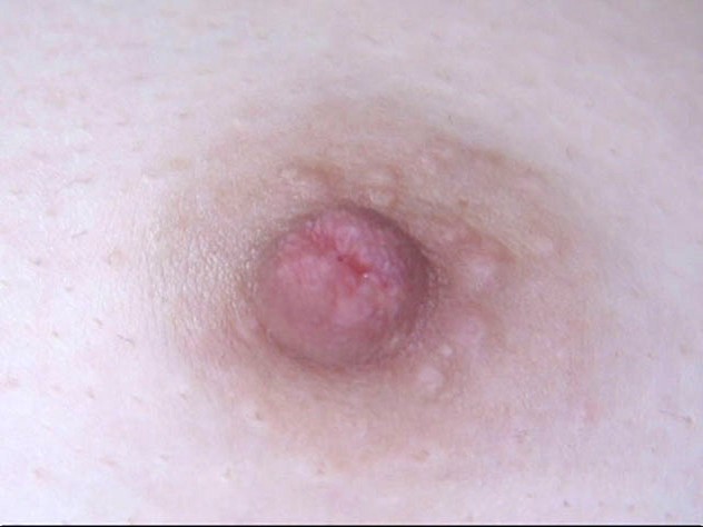 GA-294 第 2 部分 - 35 分钟