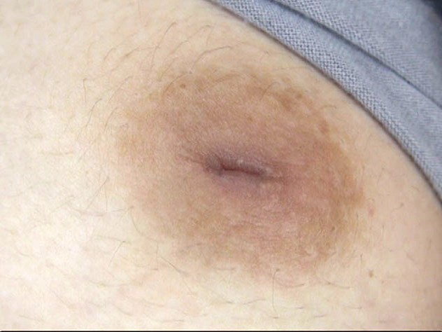 GA-294 第 3 部分 - 40 分钟