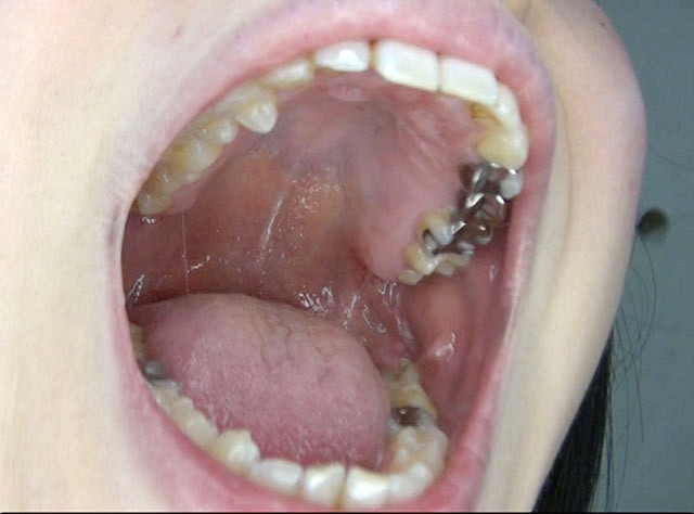 GA-300 パート 10 - 66 分